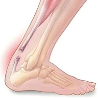 94